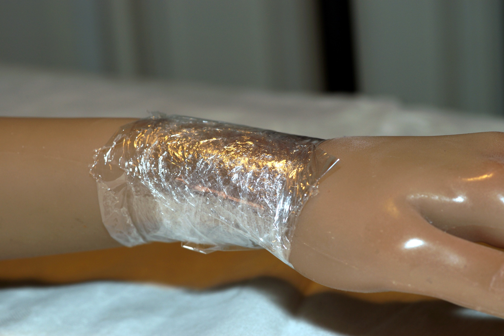 Tightening the wound when silicone is curing- Wrist Joint Repair