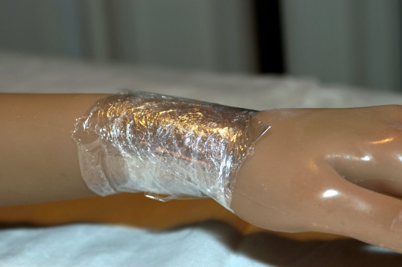 Tightening the wound - Wrist Joint Repair
